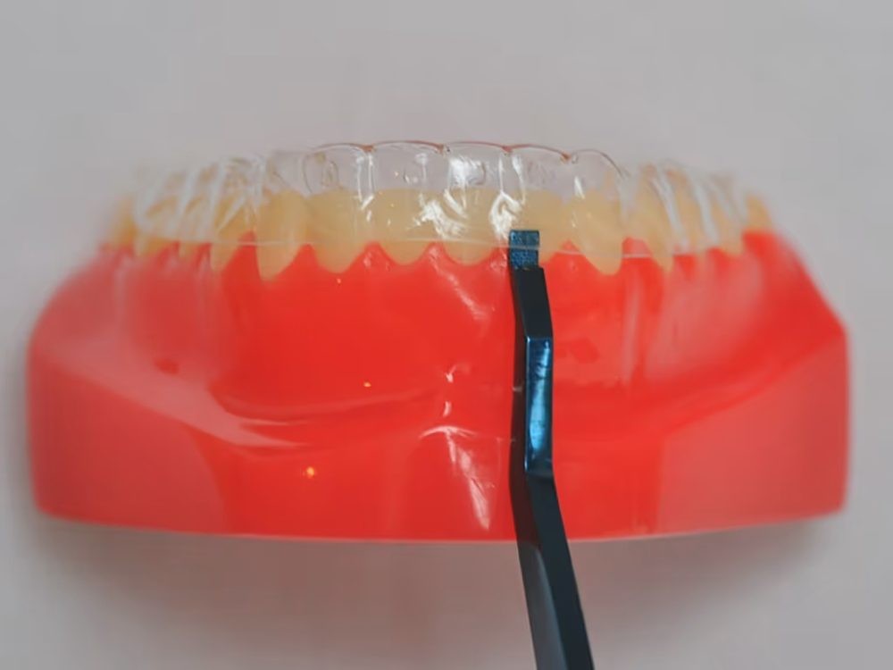 Aligner Removal Tool S.S